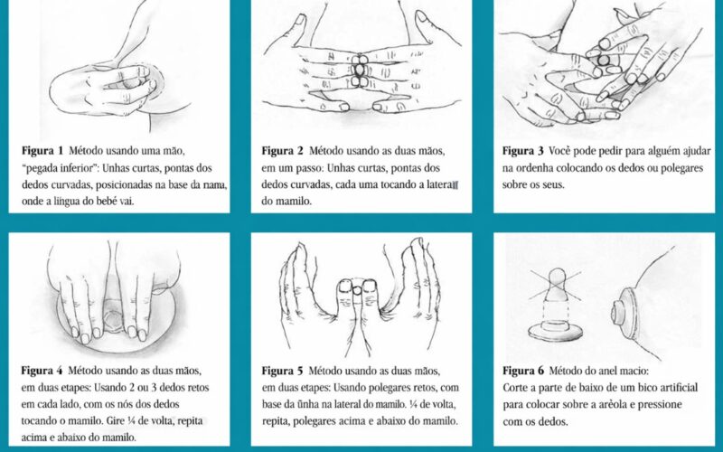 Técnica manual para aliviar ingurgitamento (“empedramento”) da aréola