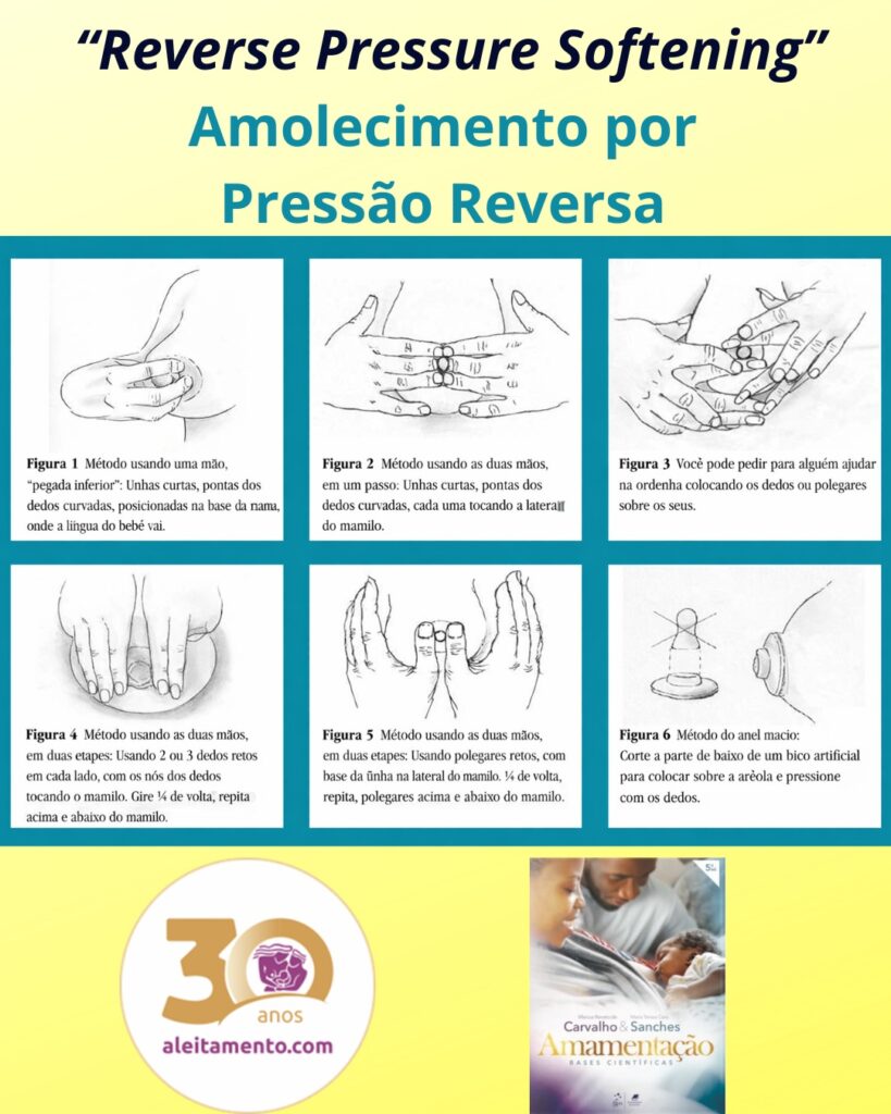 Técnica manual para aliviar ingurgitamento (“empedramento”) da aréola
